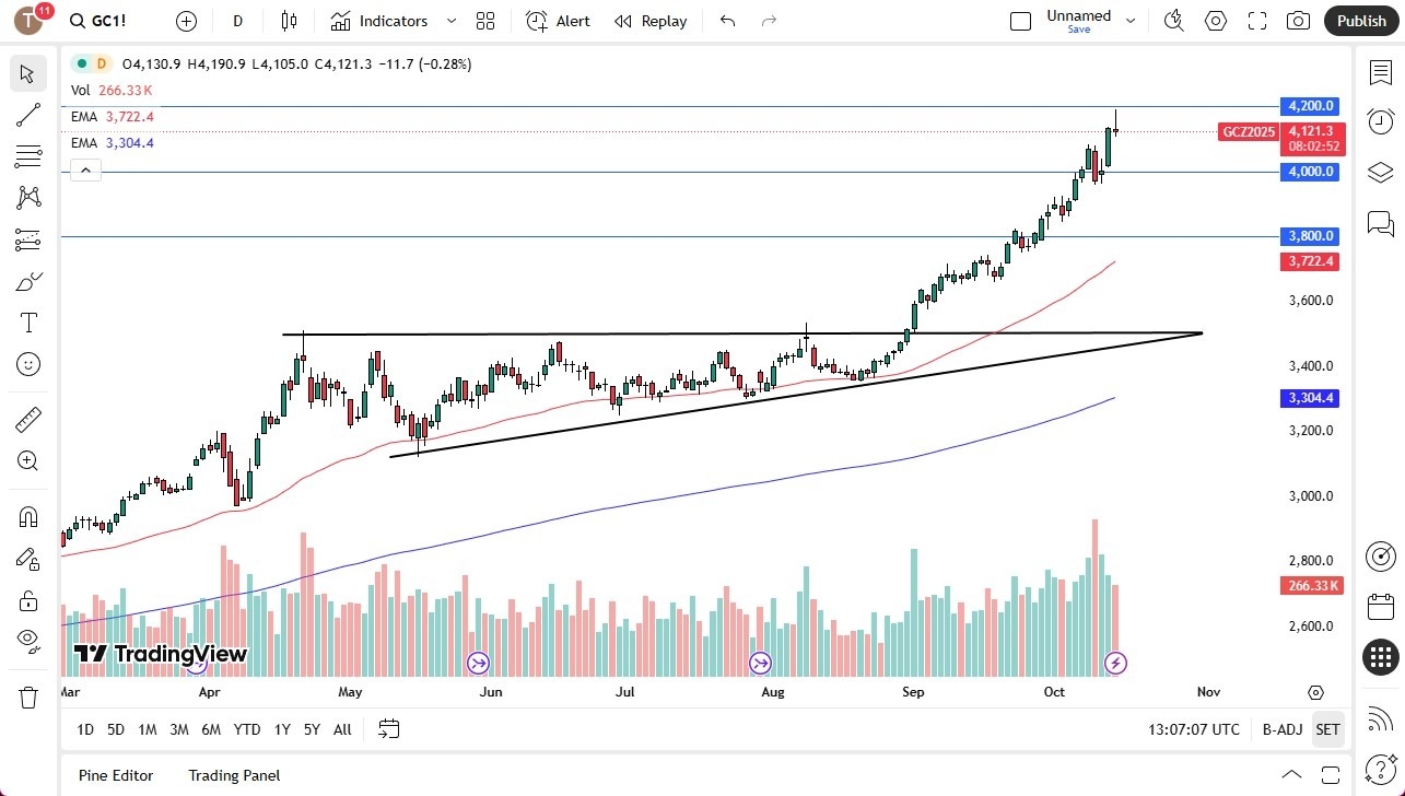【XM Market Review】--Gold Forecast: Market Awaits Pullback for Value(图1) 【XM Market Review】--Gold Forecast: Market Awaits Pullback for Value(图1)